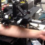 Българин с уникален пробив: Лазер засича и унищожава в реално време раковите клетки циркулиращи в кръвта